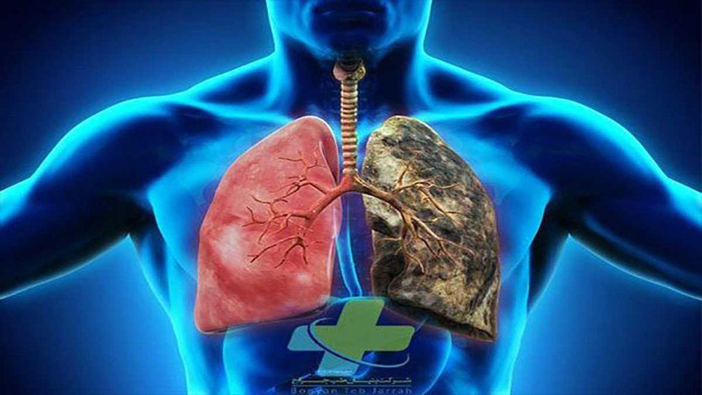 دکتر متخصص نای دکتر قلب و ریه