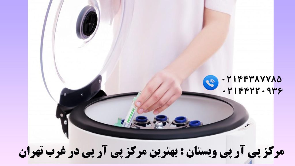 یک سانتریفیوژ و چند عدد ظرف استخراج پلاسما