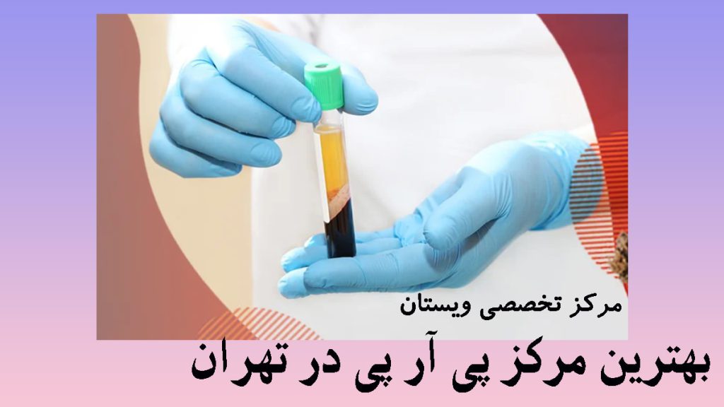 یک ظرف حاوی پی ار پی در دست پزشک -نوشته : بهترین مرکز پی آر پی در تهران