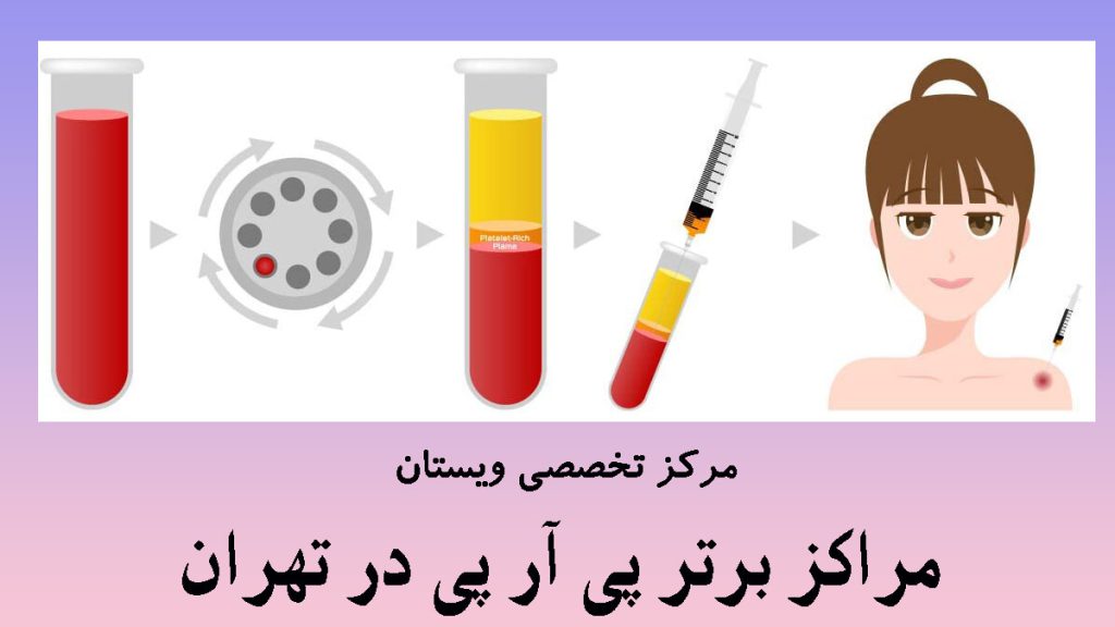 مراحل استخراج پی ار پی و تصویری از یک خانم در حال تزریق به شانه