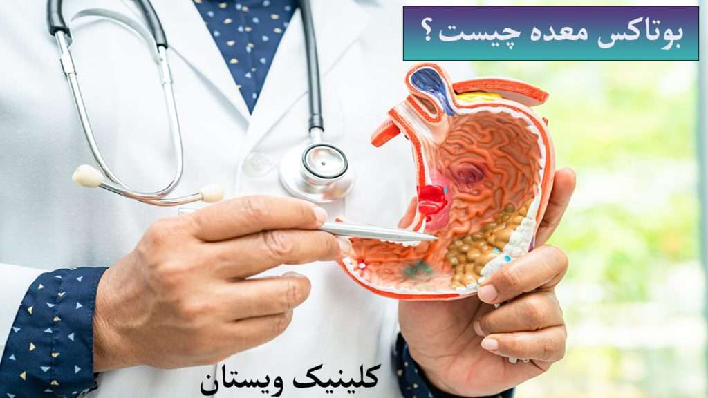 بوتاکس معده چیست؟پزشک در حال توضیح معده برای پاسخ به این سوال است