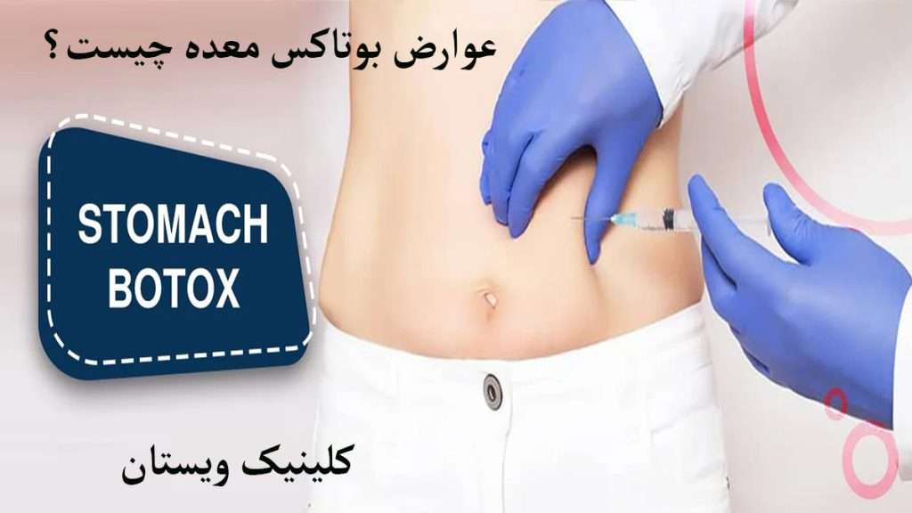 پزشک در حال تزریق بوتاکس به معده شخص