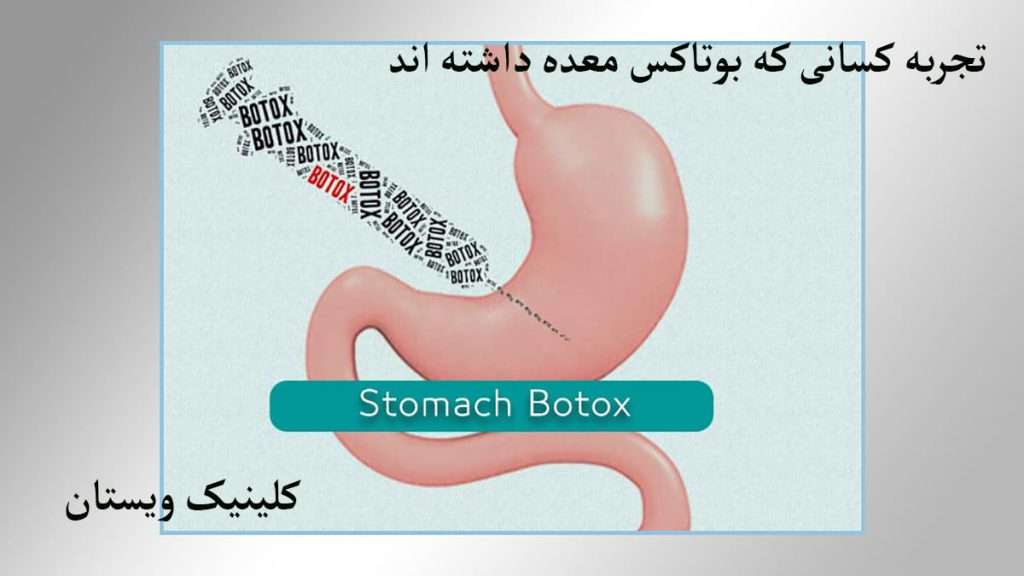 تزریق بوتاکس به معده نمایش داده می شود