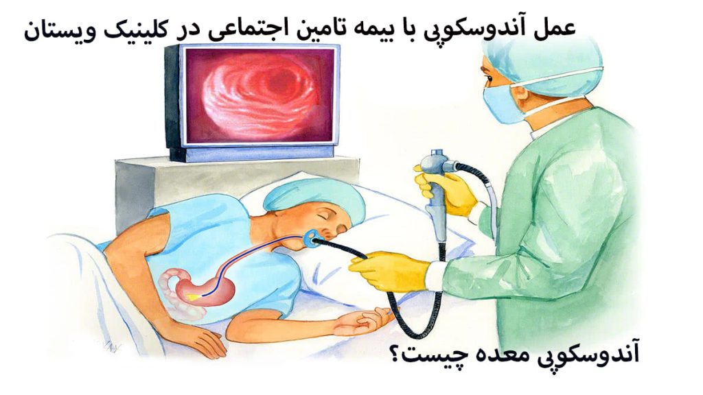 پزشک در حال انجام اندوسکوپی معده و نوشته ای با عنوان آندوسکوپی معده با بیمه تامین اجتماعی در کلینیک ویستان