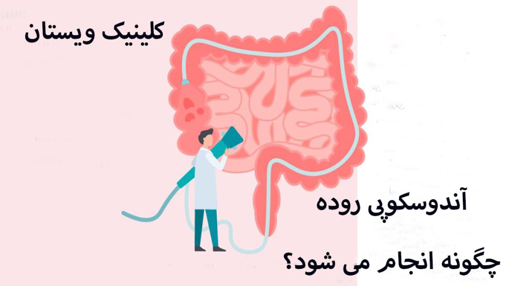 یک پزشک در حال انجام اندوسکوپی به صورت انیمیشنی