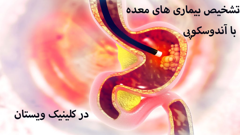 دستگاه آندوسکوپی در معده و نوشته ای با عنوان تشخیص بیماری ها با اندوسکوپی مشاهده می شود