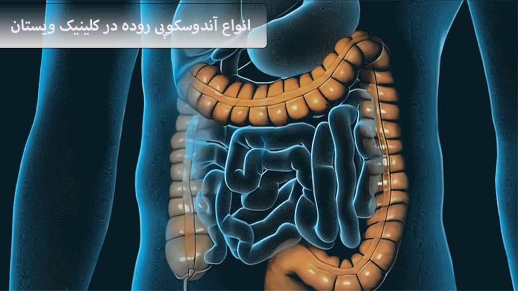 داخل شکم و روده نمایش داده می شود