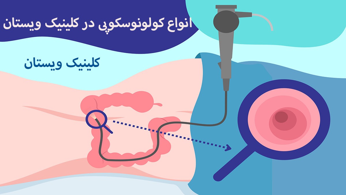 یک شخص بر روی تخت دراز کشیده و بر روی او عمل کولونوسکوپی انجام می شود + هزینه کولونوسکوپی در بیمارستان آتیه یک شخص بر روی تخت دراز کشیده و بر روی او عمل کولونوسکوپی انجام می شود + هزینه کولونوسکوپی