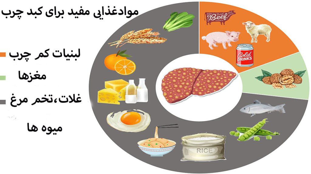 موادغذایی مناسب برای کبد نشان داده شده است