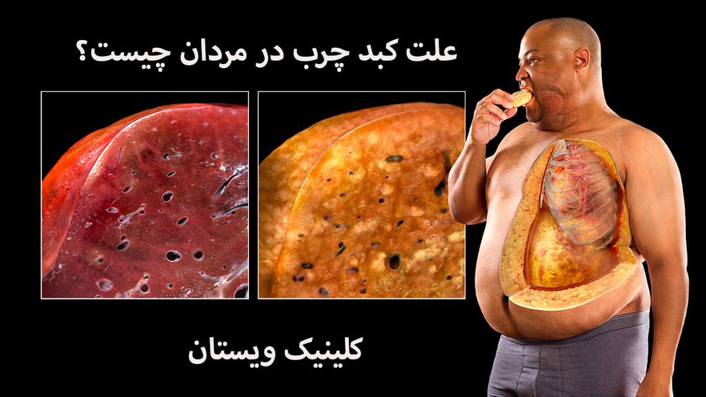 یک آقا در خال خوردن غذا و یک کبد سالم و یک کبد چرب نمایش داده می شود