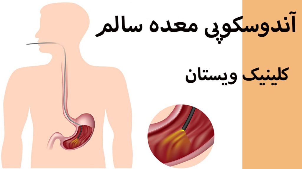 یک فرد در سمت چپ که در حال انجام اندوسکوپی معده قرار گرفته است-تصویری از معده و دستگاه اندوسکوپی