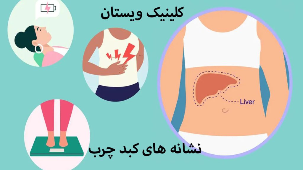 نشانه های کبد چرب مانند خستگی و اضافه وزن