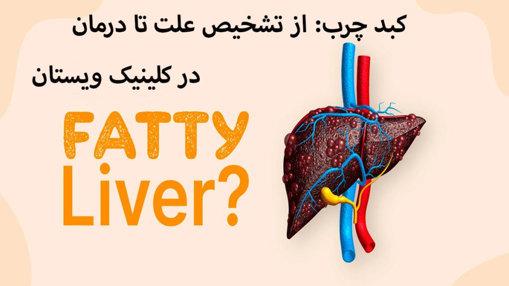 کبد در سمت راست و نوشته ای در خصوص چرب یکبد رد ربالا نمایش داده می شود