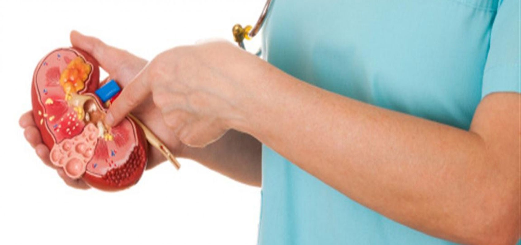 عفونت کلیه از چیه