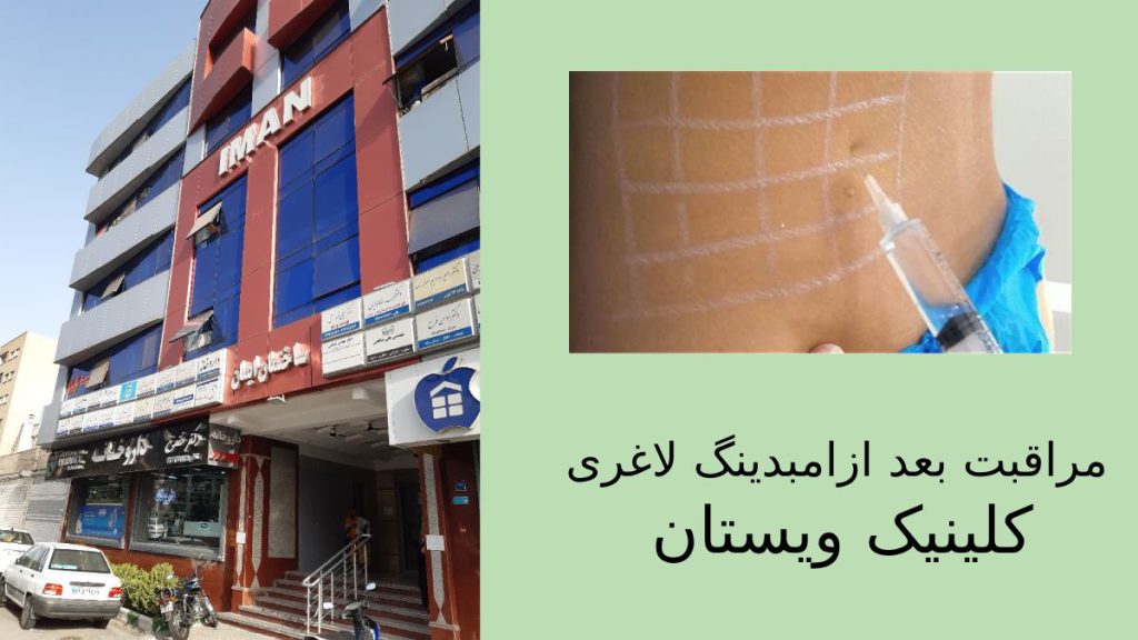 توصیه های مراقبتی متخصصان امبدینگ کلینیک ویستان  