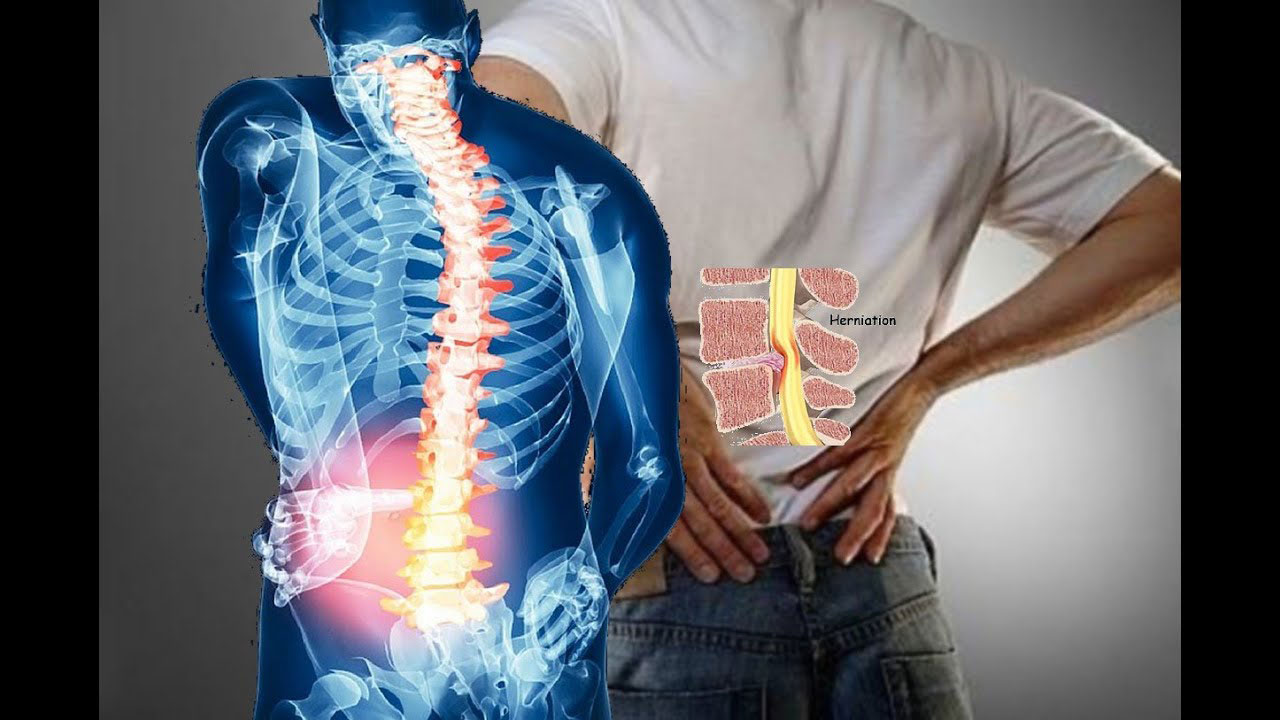 پی آر پی کمر