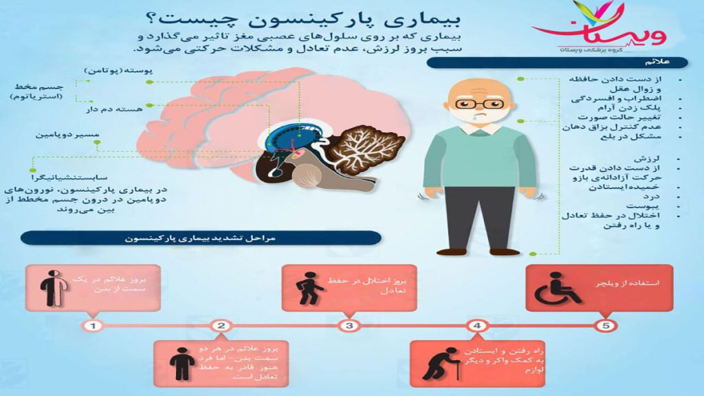 علت های بیماری پارکینسون 9 علت اصلی بیماری پارکینسون