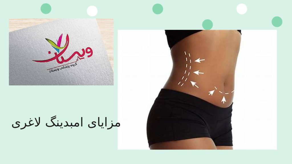 خانمی که امبدینگ لاغری انجام داده و از مزایای آن بهره مند شده