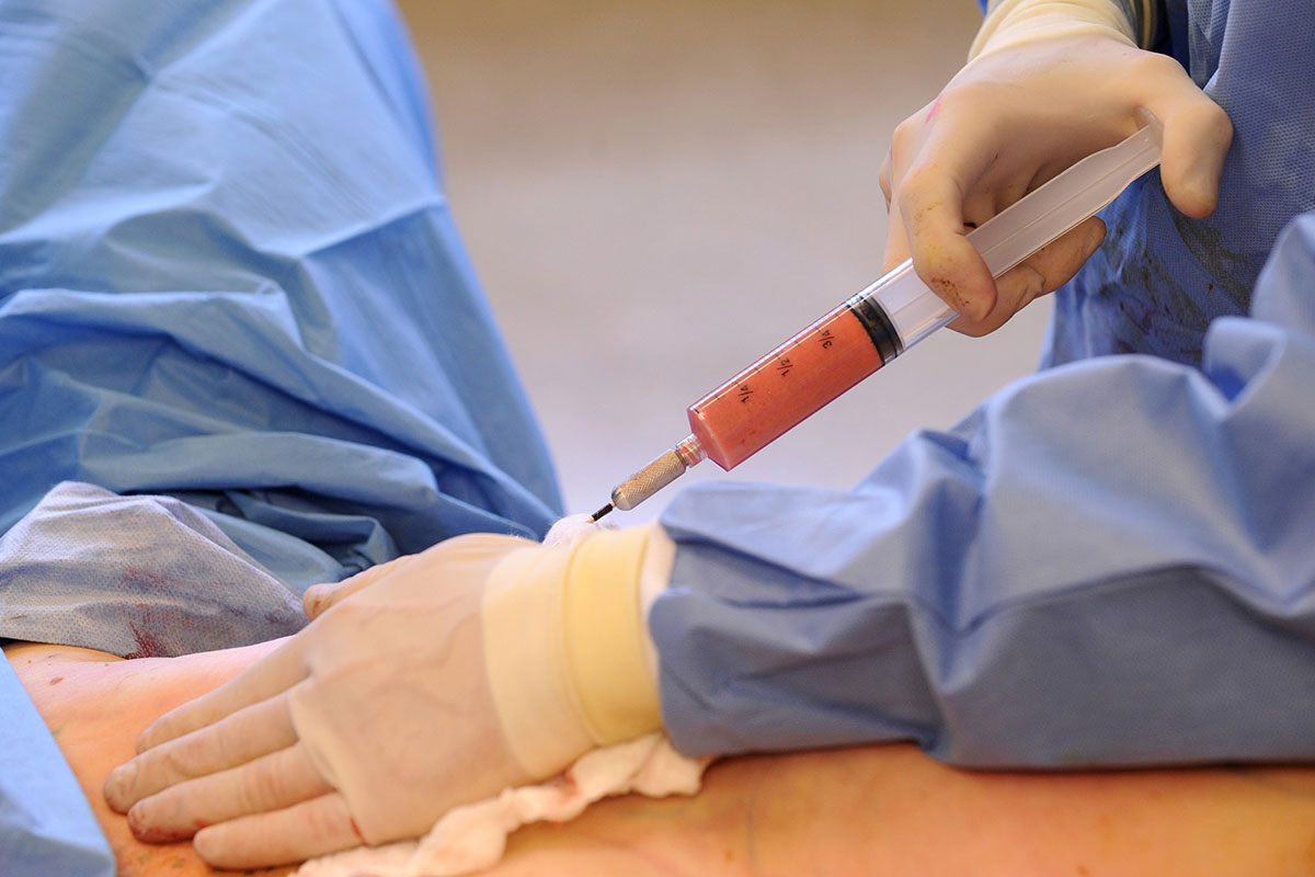 تزریق بوتاکس معده برای لاغری 