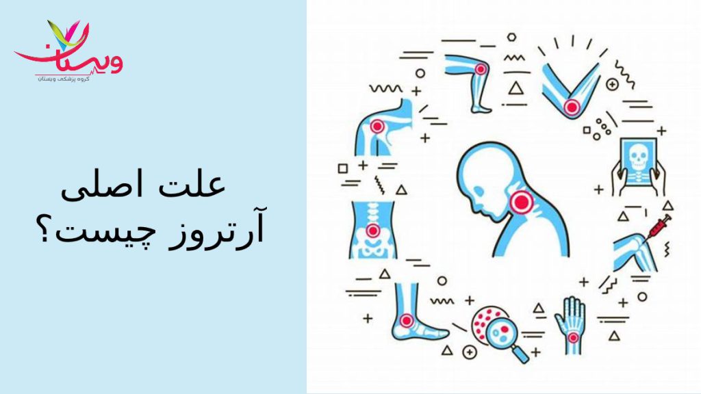 شناخت علت اصلی انواع بیماری تخریب مفاصل ودرمان 
