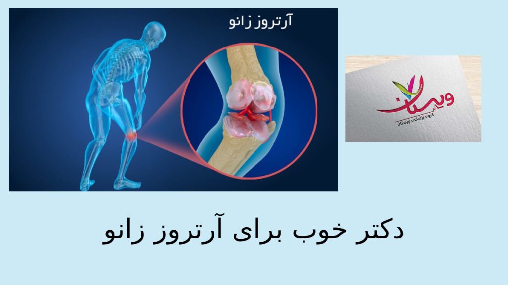 زانوی انسانی که دچار ساییدگی وخشکی شده است