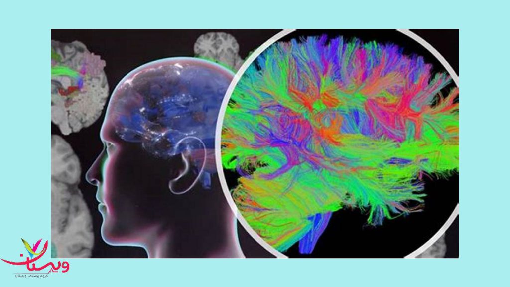 تشخیص دقیق آلزایمر بررسی نقشه مغزی برای تشخیص بیماری آلزایمر