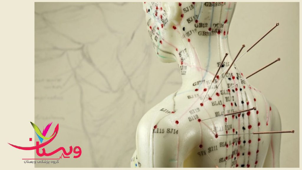 بدن فردی که برای درمان با طب شرقی علامت گذاری
 شده 