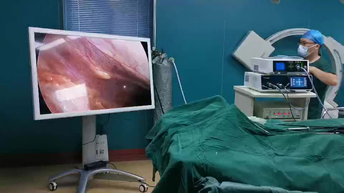 کولونوسکوپی درد دارد درد بعد از کولونوسکوپی