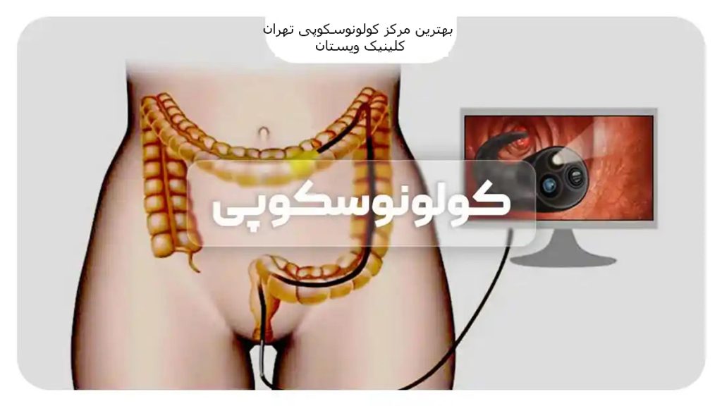 چه زمانی کولونوسکوپی لازم است