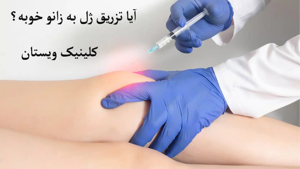 یک پزشک با دستکش آبی در حال تزریق ژل به زانو