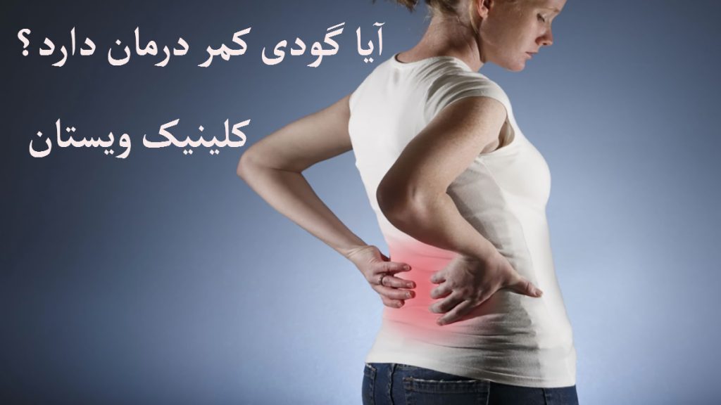 تصویری نیم رخ از یک خانم که به کمر درد مبتلا است