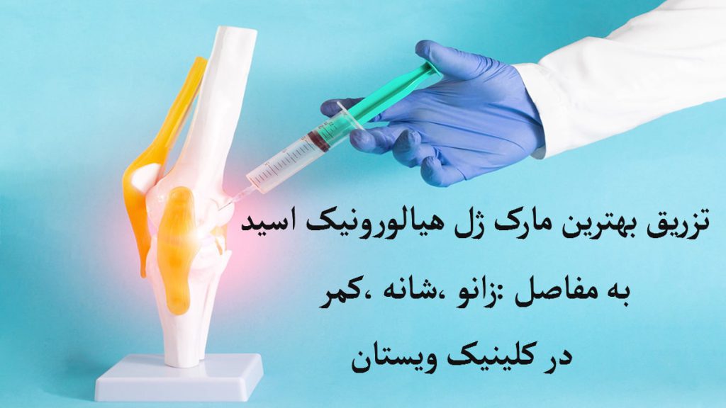 دست یک پزشک که به صورت نمادین در حال تزریق ژل به مفصل زانو است