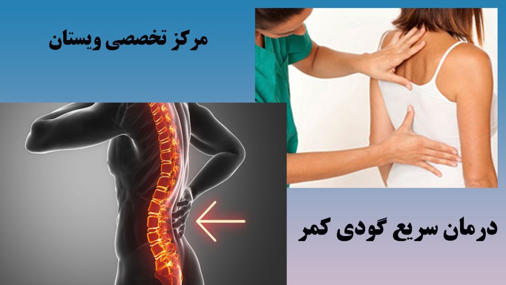 دو تصویر از گودی کمر و درمان آن توسط یک پزشک-نوشته : درمان سریع گودی کمر