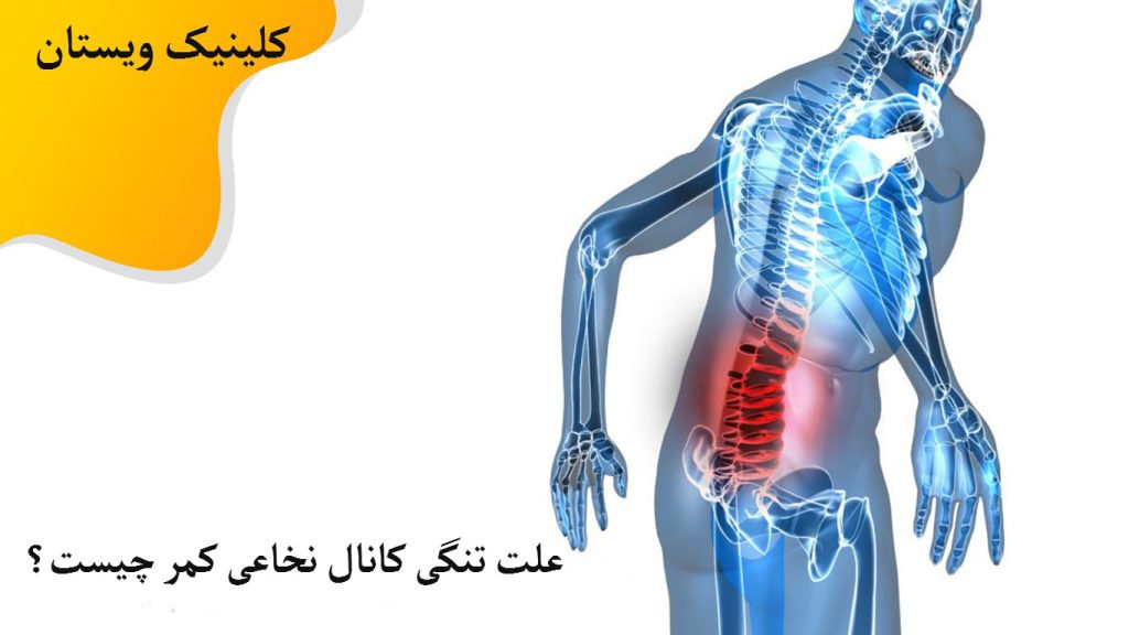 یک شخص در تصویری دیجیتالی که درد در ناحیه کمر او با رنگ قرمز نشان داده شده است