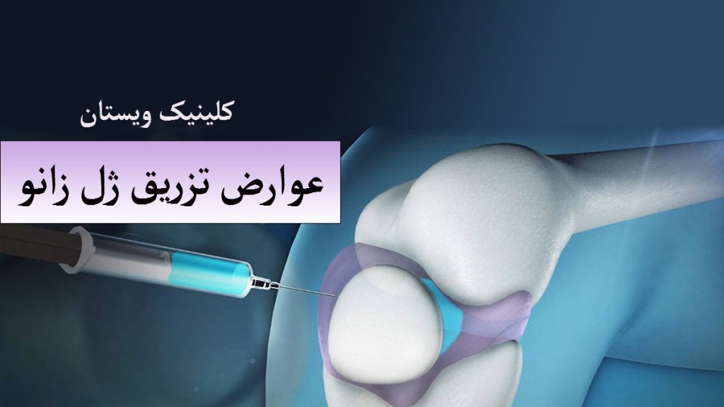 عکسی دیجیتالی از مفصل زانو و یک سرنگ در حال تزریق به آن