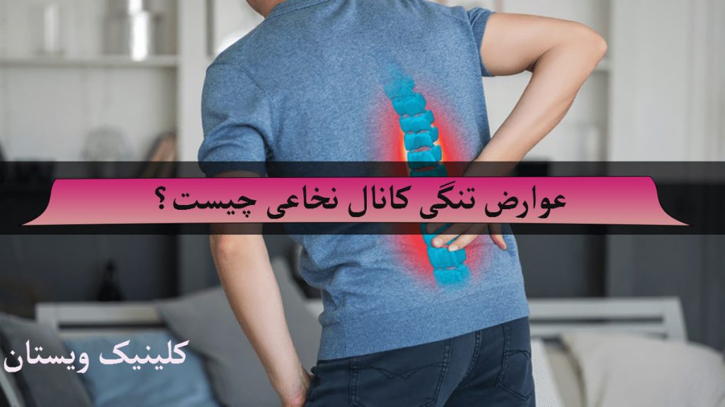 یک شخص که به علت داشتن کمر درد دستش را به کمرش گرفته است