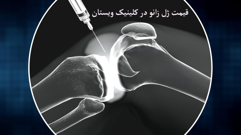 گرافی به رنگ تیره از مفصل زانو در حال تزریق ژل