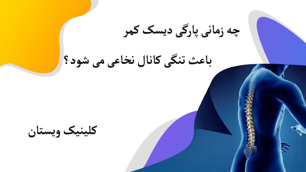 تصویری دیجیتالی از یک شخص از پهلو و ستون فقرات او که مشخص است