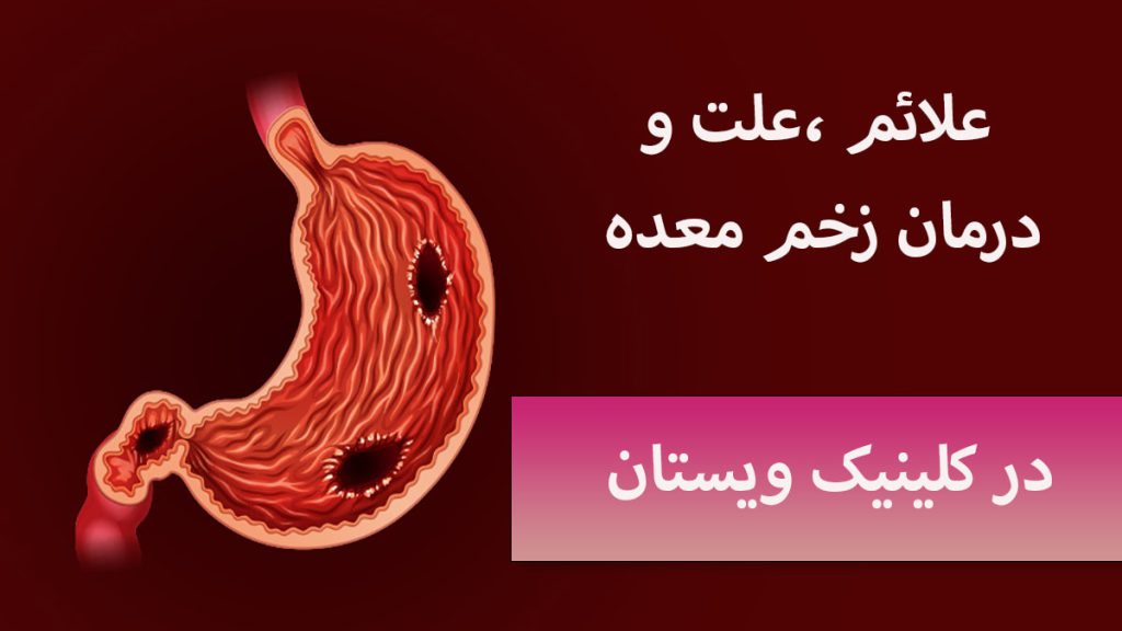 یک معده دچار زخم معده شده است در پس زمینه تیره