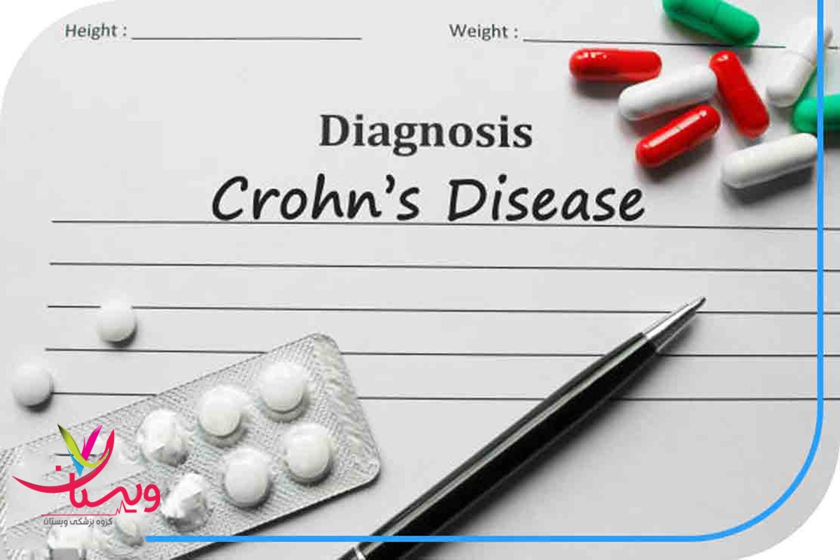 دارو برای بیماری کرون روده