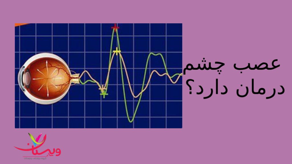 عصب بینایی که دچار مشکل شده وایا درمان دارد؟