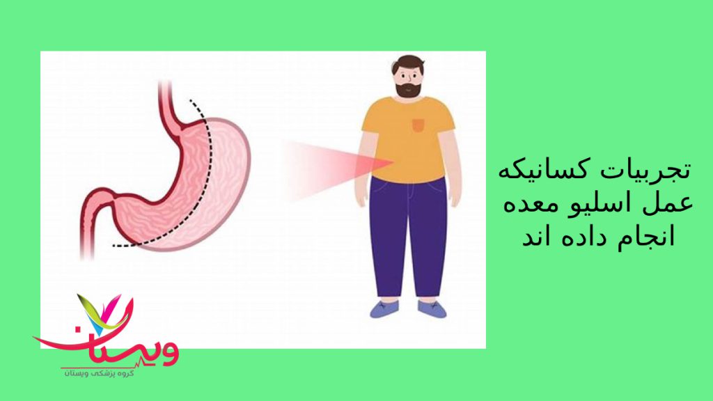 برخی از تجربیات رایج در جراحی اسلیو اقایی که برای کاهش وزن وبیماری نیاز به عمل اسلیو معده دارد