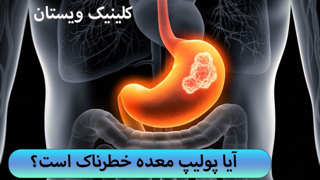 یک معده در پپس زمینه تیره