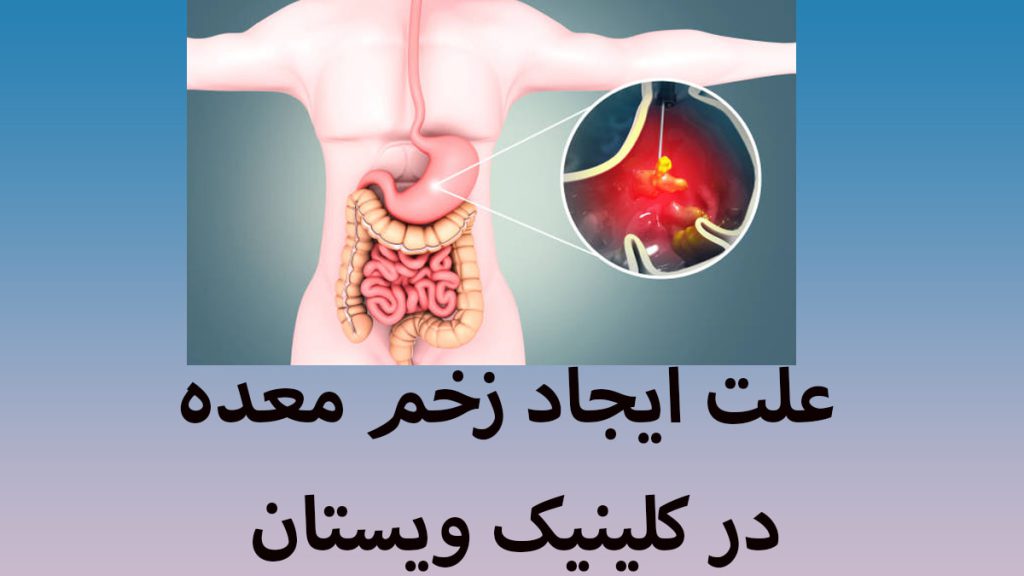 داخل بدن انسان و یک تصویر زوم شده از زخم معده او
