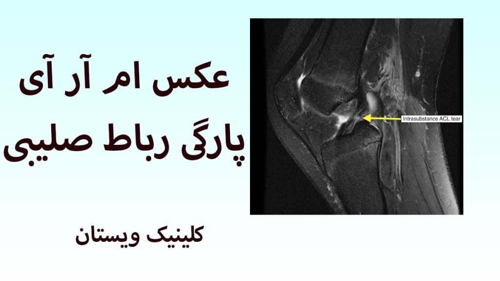 یک تصویر رادیولوژی از زانو در پس زمینه سبز