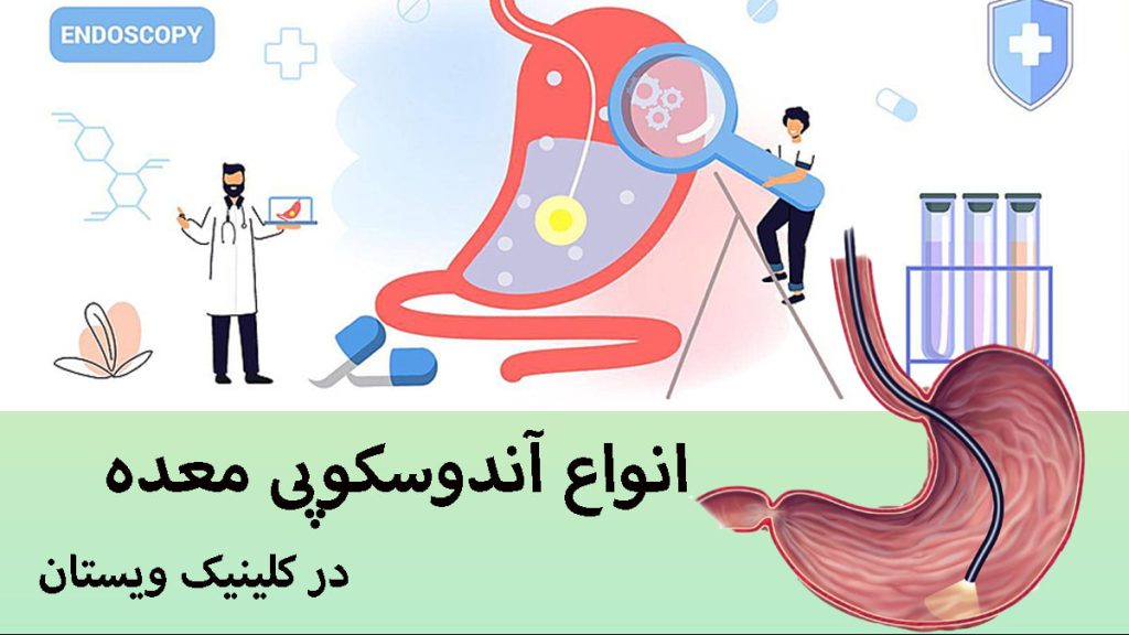 دو تصویر از آندوسکوپی معده که توسط پزشک انجام می شود-تصویر انیمیشنی است