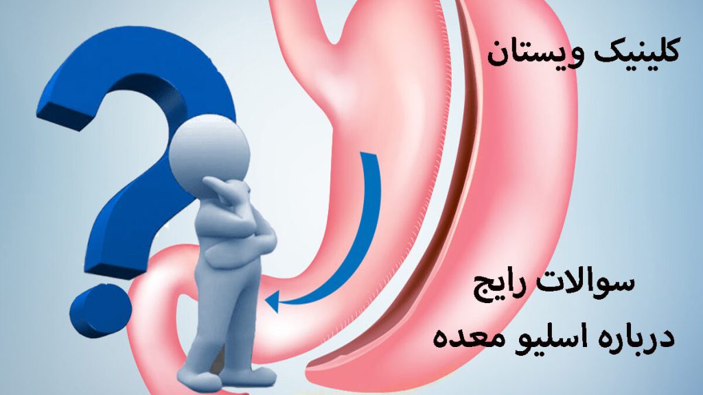 یک آدمک در کنار تصویری از معده که جراحی اسلیو انجام داده است