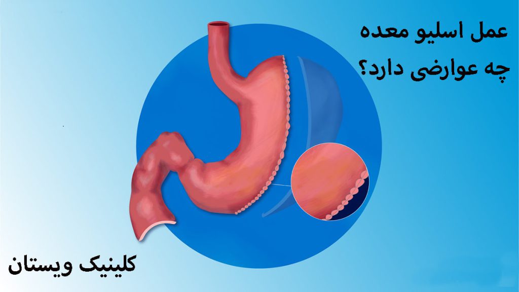 یک معده در پس زمینه آبی-تصویر انیمیشنی