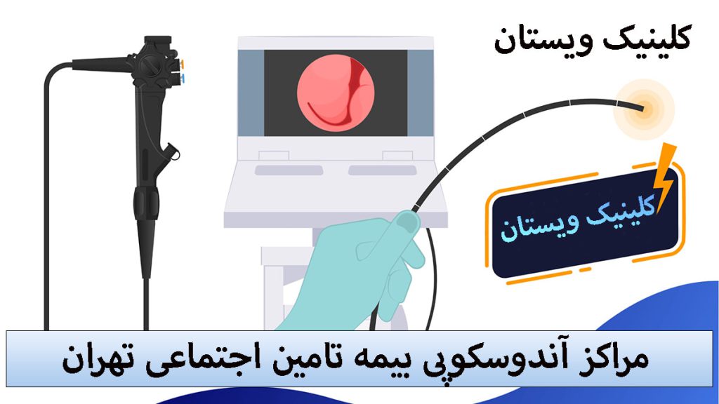 تصویری انیمیشنی از آندوسکوپی معده