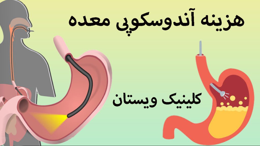 دو تصویر در یک قاب از آندوسکوپی معده